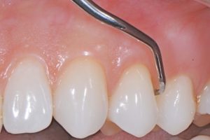 Clínica Dental Jaraíz de la Vera